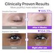 کرم دور چشم نامبوزین No.9 NAD+ Retinol Volumetox Eye Cream حجم 10 میل