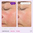 Major Fade Hyper Serum  سرم روشن‌کننده فوری لک و تیرگی