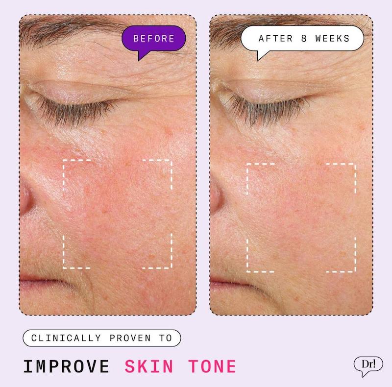 Major Fade Hyper Serum  سرم روشن‌کننده فوری لک و تیرگی