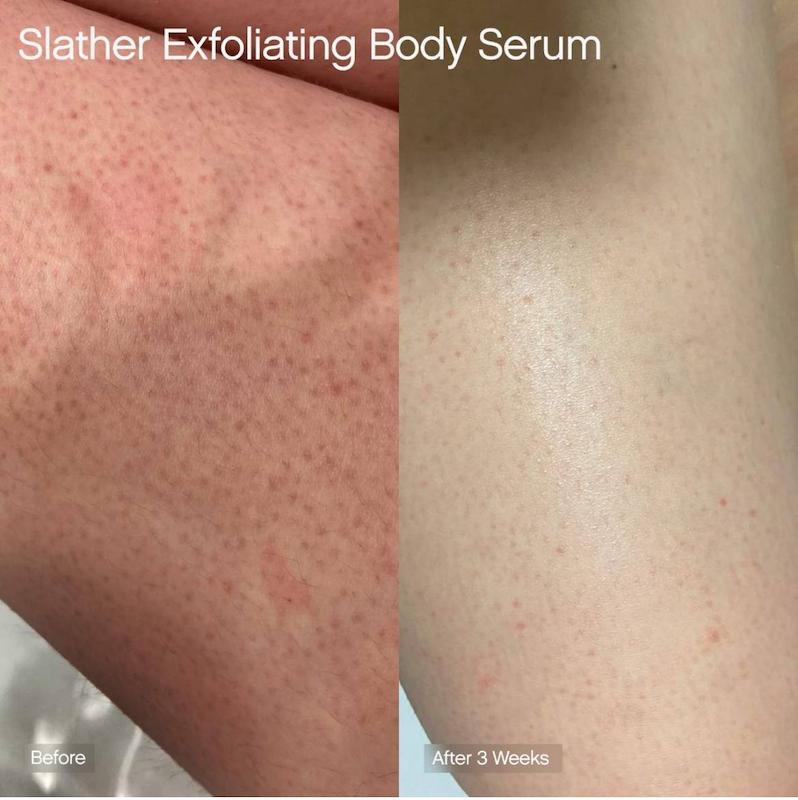 سرم بدن با رتینول + AHAs + اوره Topicals Slather 