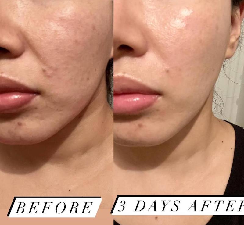 Advanced Retinol + Ferulic Texture Renewal Serum-کپی
