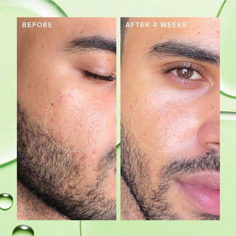 تونر پاکسازی منافذFarmacy