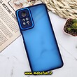 قاب گوشی Redmi Note 11 Pro 4G Global - Redmi Note 11 Pro 5G Global - Redmi Note 11E Pro 5G شیائومی پشت مات متال کیس دور سیلیکونی محافظ لنزدار سرمه ای کد 490