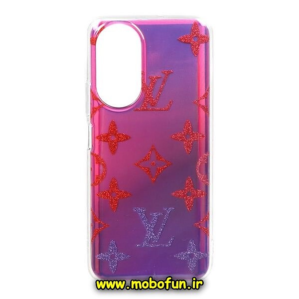قاب گوشی Honor X7 4G آنر طرح هولوگرامی لویی ویتون LV کد 181