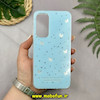 قاب گوشی Galaxy A35 سامسونگ اورجینال Unique Case فانتزی Hard لیزری طرح پروانه کیوت کد 52385