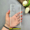 قاب گوشی Xiaomi 12 Lite شیائومی پشت طلقی HARD سخت شیشه ای شفاف محافظ لنزدار کپسولی بی رنگ کد 63996