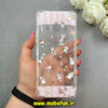 قاب گوشی Redmi A3 / Redmi A3X شیائومی طرح دار فانتزی عروسکی ژله ای شفاف محافظ لنز دار کپسولی (لاکچری) کیوت کد 64801
