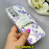 قاب گوشی Galaxy A15 سامسونگ اورجینال فانتزی سخت لیزری کرومی محافظ لنزدار طرح CHANEL کد 64325