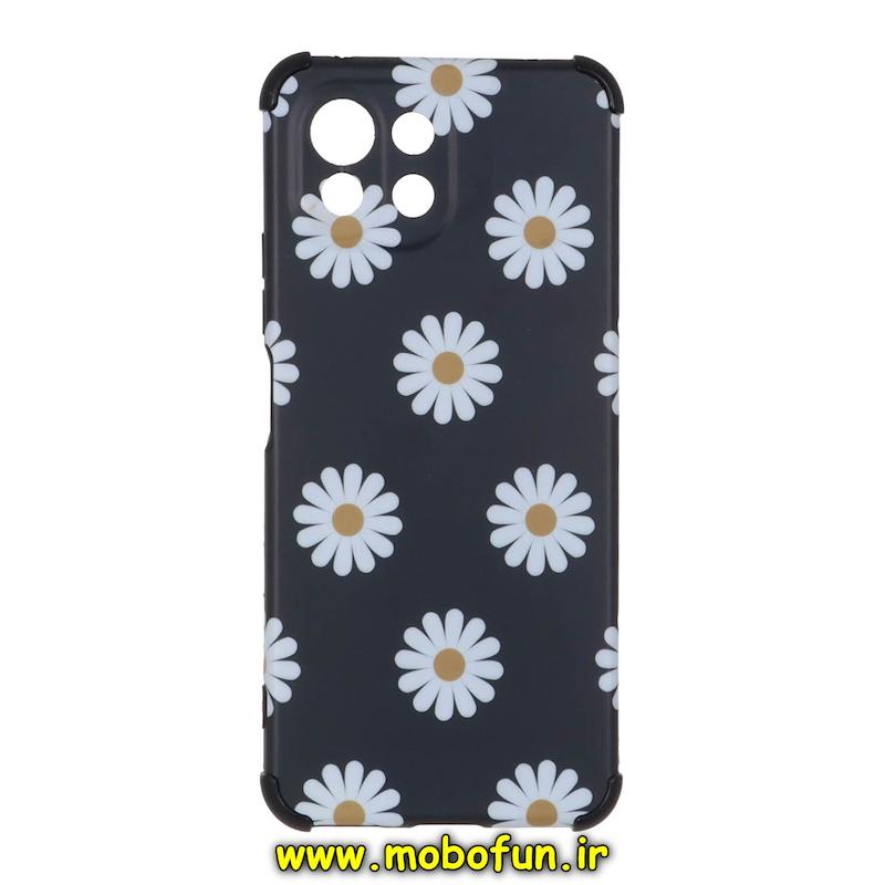 قاب گوشی Mi 11 Lite 4G / Mi 11 Lite 5G / Mi 11 Lite NE شیائومی فانتزی هارد HARD ایربگ دار کپسولی محافظ لنز دار کد 72907