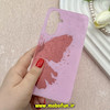 قاب گوشی Galaxy A56 سامسونگ ماربل لاکچری سخت طلقی Hard طرح پروانه کد 81417