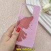 قاب گوشی Redmi Note 14 4G شیائومی ماربل لاکچری سخت طلقی Hard طرح پروانه کد E20-81431