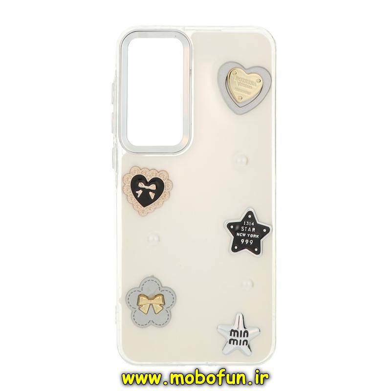 قاب گوشی Galaxy A55 سامسونگ فانتزی برجسته رزینی Luxury Case لنز و دکمه کرومی کد 75212