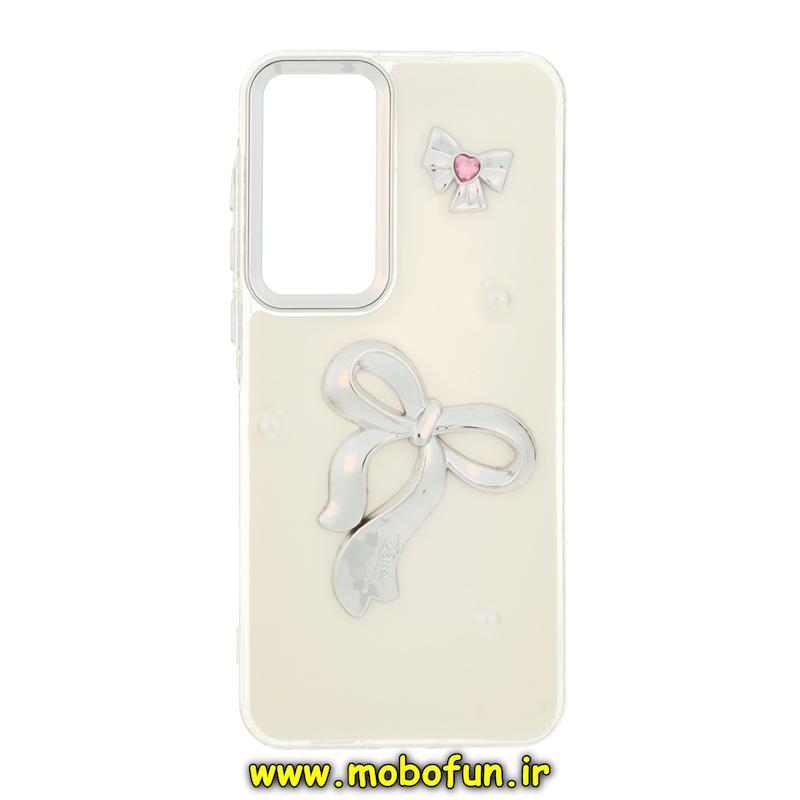 قاب گوشی Galaxy A55 سامسونگ فانتزی برجسته رزینی Luxury Case لنز و دکمه کرومی کد 75217