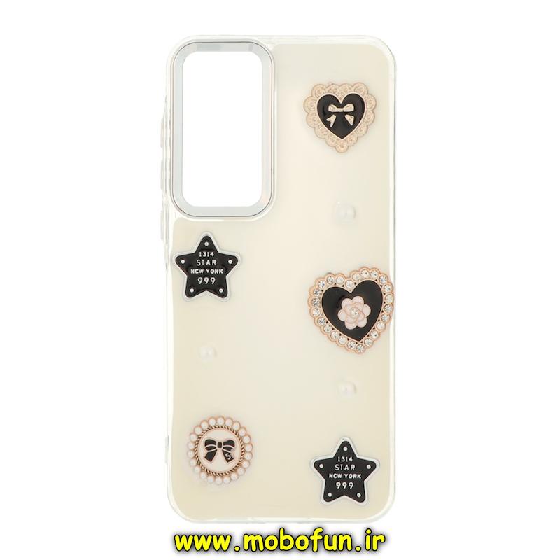قاب گوشی Galaxy A55 سامسونگ فانتزی برجسته رزینی Luxury Case لنز و دکمه کرومی کد 75218