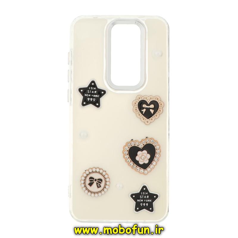 قاب گوشی Redmi Note 8 Pro شیائومی فانتزی برجسته رزینی Luxury Case لنز و دکمه کرومی کد 76380