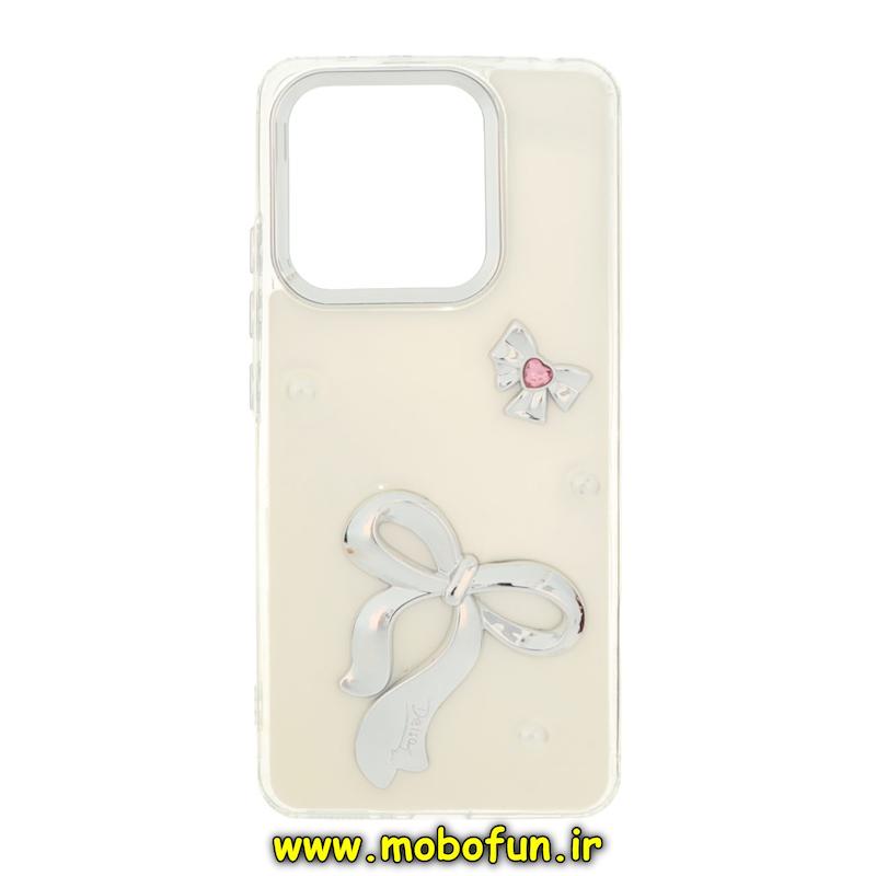 قاب گوشی Redmi Note 13 4G شیائومی فانتزی برجسته رزینی Luxury Case لنز و دکمه کرومی کد 76484