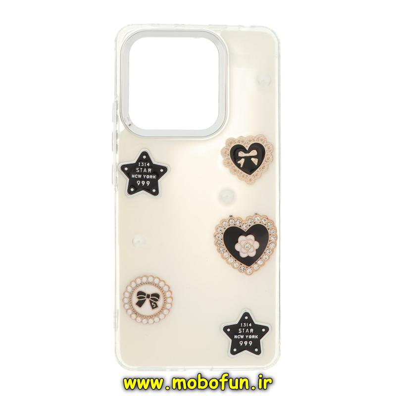 قاب گوشی Redmi Note 13 4G شیائومی فانتزی برجسته رزینی Luxury Case لنز و دکمه کرومی کد 76486