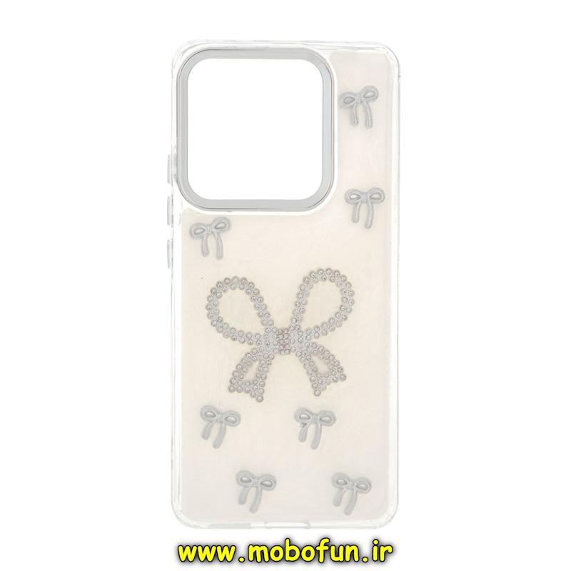 قاب گوشی Redmi Note 14 4G شیائومی فانتزی برجسته رزینی Luxury Case لنز و دکمه کرومی کد 76607