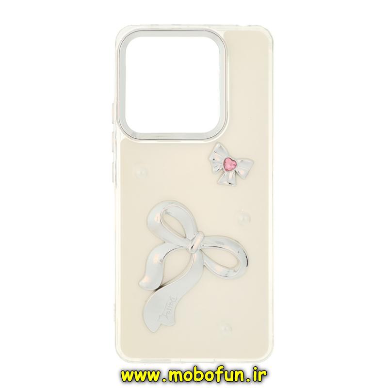 قاب گوشی Redmi Note 14 4G شیائومی فانتزی برجسته رزینی Luxury Case لنز و دکمه کرومی کد 76612