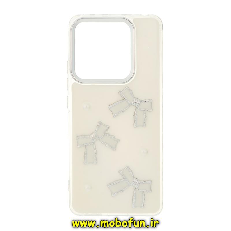 قاب گوشی Redmi Note 14 4G شیائومی فانتزی برجسته رزینی Luxury Case لنز و دکمه کرومی کد 76613