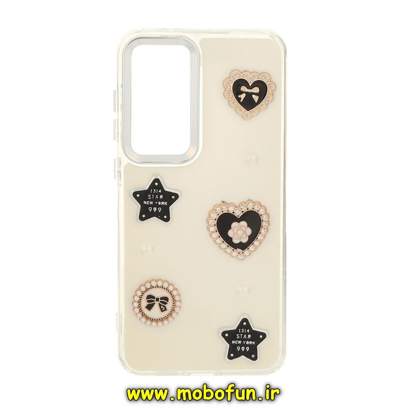 قاب گوشی Galaxy S24 FE سامسونگ فانتزی برجسته رزینی Luxury Case لنز و دکمه کرومی کد 76877