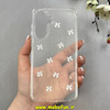 قاب گوشی Galaxy A36 سامسونگ طلقی Hard شفاف رزینی برجسته اکلیلی شاین طرح پاپیونی کیوت کد 1-15-100279