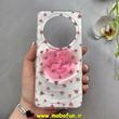 قاب گوشی Redmi 14C / Poco C75 / Redmi A4 شیائومی فانتزی سخت Hard لیزری لاکچری طرح گل کیوت کد 102683