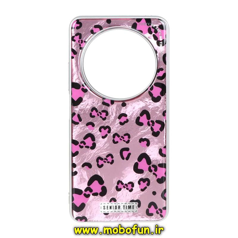 قاب گوشی Redmi 14C / Poco C75 / Redmi A4 شیائومی لاکچری اورجینال فانتزی رزینی طرح پلنگی کد 95046