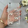قاب گوشی iPhone X - iPhone XS آیفون لاکچری شفاف شاین رزینی لنز کرومی طرح پاپیون و مروارید برجسته کد 116142