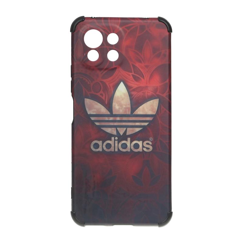 قاب گوشی Xiaomi Mi 11 Lite 4G - Mi 11 Lite 5G - Mi 11 Lite Ne شیائومی فانتزی هارد HARD ایربگ دار کپسولی محافظ لنزدار adidas کد 127228
