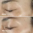 کرم دور چشم ضد چروک هوشمند کلینیک حجم 15 میلی لیتر^