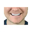 روکش دندان طرح لبخند فک بالا