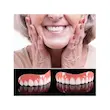 روکش دندان طرح لبخند فک بالا