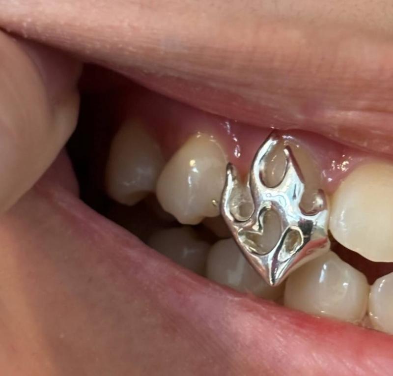 روکش دندان گریلز طرح شعله آتش