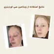 کرم ویتامین سی اوردینری ضد لک و روشن کننده