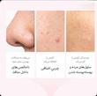 فوم شستشو هلو نیاسینامید آنوا – روشن کننده و لایه بردار ملایم / ANUA
