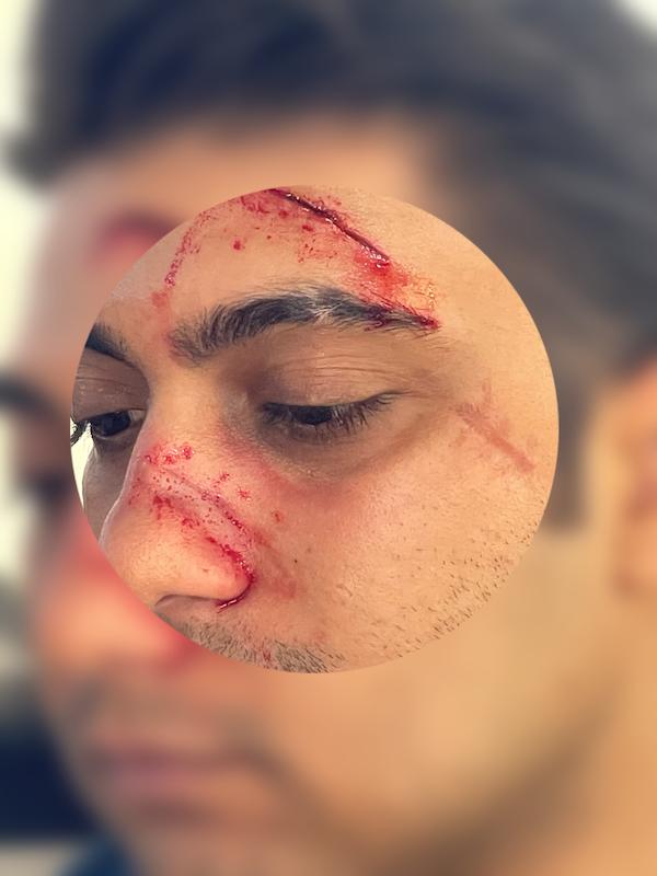 کلاس مجازی گریم اسپشیال ( زخم ها ) 