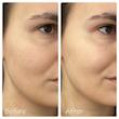 تونر آبرسان و درخشان کننده سنتلا هیالو سیکا اسکین 1004 Centella Hyalu-Cica Brightening Toner