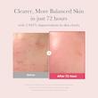 سرم ترانگزامیک اسید و نیاسینامید ۱۵٪ مدی‌کیوب Medicube TXA Niacinamide 15 Serum