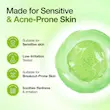 سرم تسکین دهنده و آبرسان Azelaic Acid آنوا
