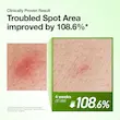 سرم تسکین دهنده و آبرسان Azelaic Acid آنوا