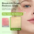 سرم تسکین دهنده و آبرسان Azelaic Acid آنوا