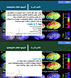 اختلال اسکیزوفرنیا بر اساس dsm-5 و dsm-TR