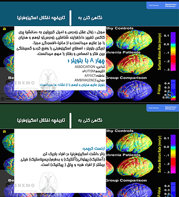 اختلال اسکیزوفرنیا بر اساس dsm-5 و dsm-TR