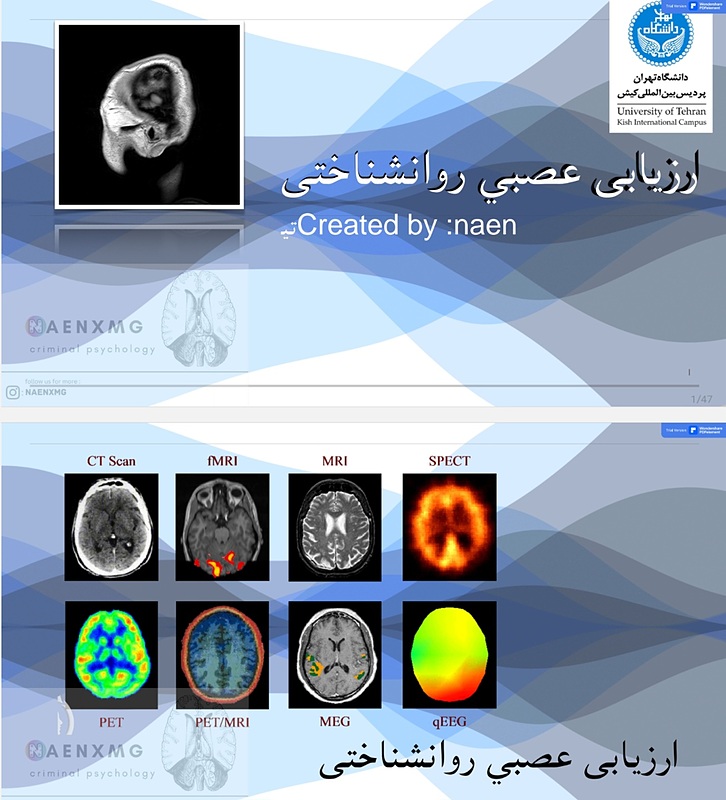روانشناختی عصبی(نوروساینس)