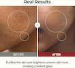تونر پیلینگ شات برنج سفید دکتر ملاکسین Dr.Melaxin Peel Shot Glow Rice Toner