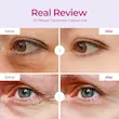 پچ زیر چشم ضدلک و پف کلسیوم دکتر ملاکسین Dr Melaxin Cemenrete Calcium Volume Eye patch