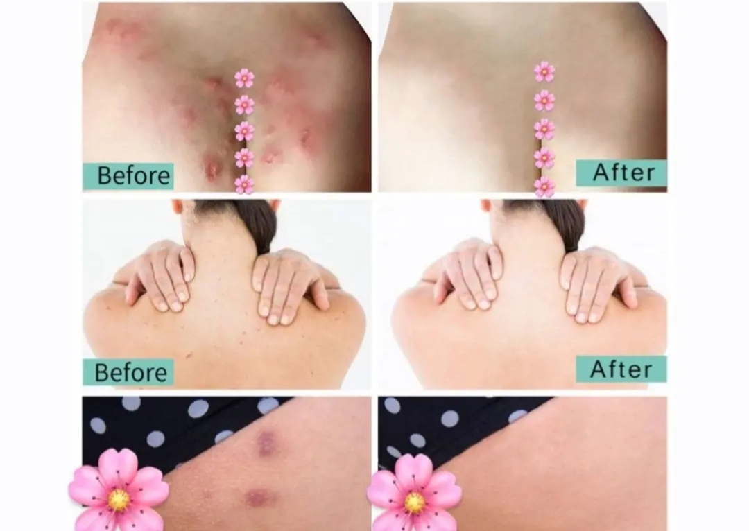 صابون اسکراب نقاط حساس بدن 