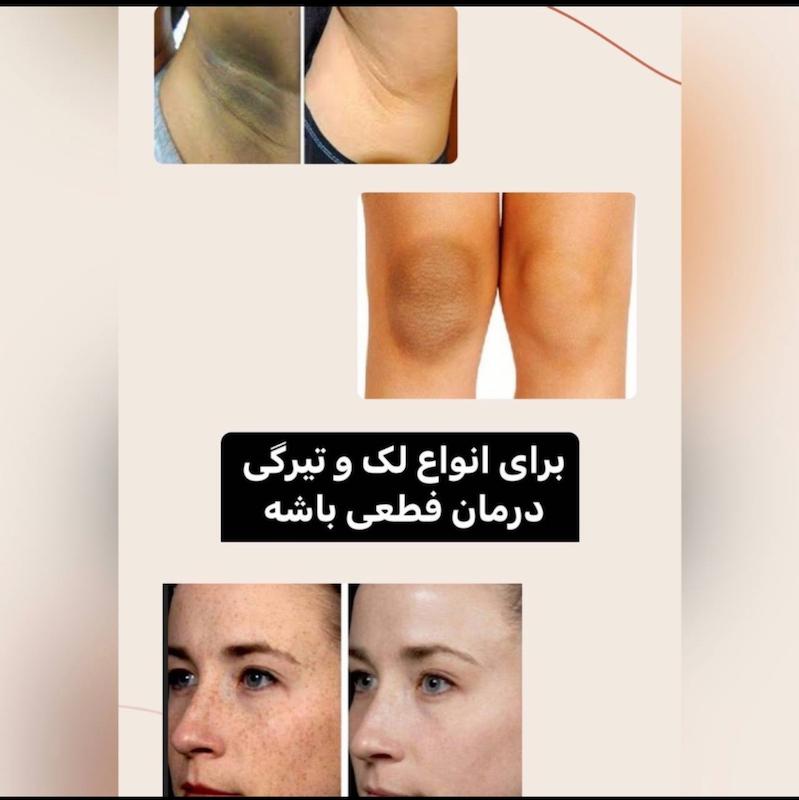 سرم روشن کننده aha