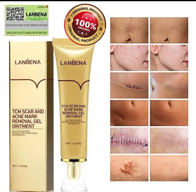 ژل ترمیم کننده و رفع جای جوش و زخم لانبنا 